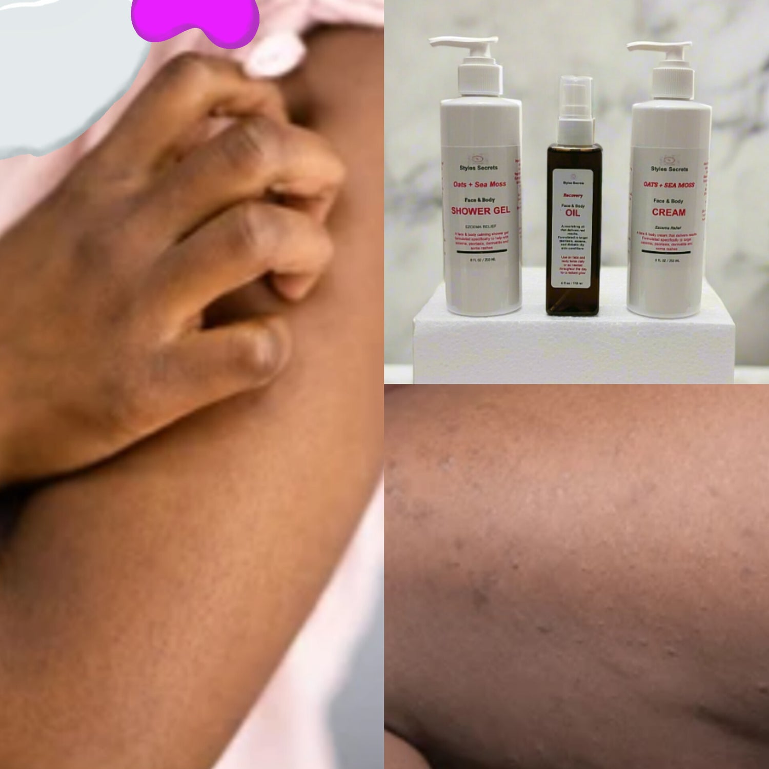 Eczema Relief Care